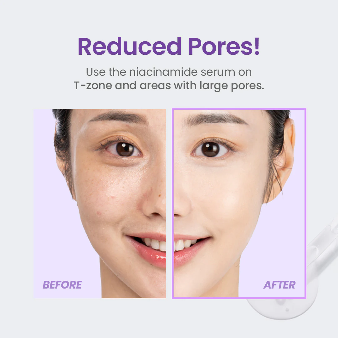 375-niacinamide-20-serum-5.webp Niacinamide 20% Serum